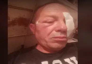 إصابة قائد قطار بعد قذف عدد من الشباب للقطار بالحجارة.. وتكريمه لإصراره على استكمال رحلته