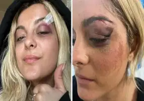 ما الذي يدفع بمعحبين لرمي أشياء عشوائية على الفنانين فوق خشبة المسرح؟