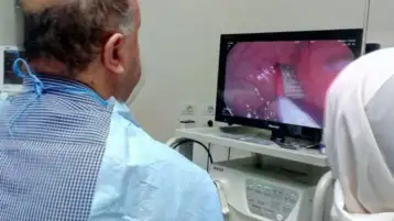 بعد 3 أشهر.. استخراج فرشاة أسنان من معدة طالبة بالدقهلية